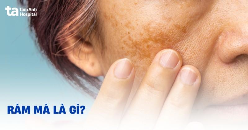 Hinh anh cac loai nguyen lieu my pham lam trang da pho bien nhu Vitamin C, Niacinamide, Arbutin